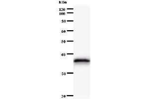 Western Blotting (WB) image for anti-AT Rich Interactive Domain 4A (RBP1-Like) (ARID4A) antibody (ABIN931104)