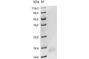 (Tris-Glycine gel) Discontinuous SDS-PAGE (reduced) with 5 % enrichment gel and 15 % separation gel.