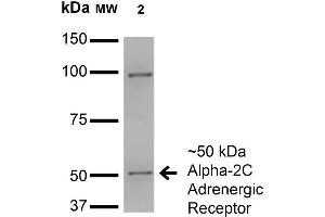 Western Blot analysis of Monkey COS cells transfected with HA-tagged Alpha-2C showing detection of ~50 kDa Alpha-2C Adrenergic Receptor protein using Mouse Anti-Alpha-2C Adrenergic Receptor Monoclonal Antibody, Clone S330A-80 . (ADRA2C Antikörper  (AA 442-462) (Atto 390))