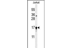 Western blot analysis of GLRX5 Antibody (C-term) (ABIN651225 and ABIN2840140) in Jurkat cell line lysates (35 μg/lane). (GLRX5 Antikörper  (C-Term))