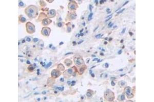 IHC-P analysis of Human Tissue, with DAB staining. (ICAM4 Antikörper  (AA 52-234))