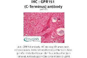 Image no. 1 for anti-G Protein-Coupled Receptor 151 (GPR151) antibody (ABIN1734968) (GPR151 Antikörper)