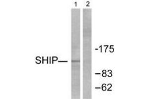 Western blot analysis of extracts from HuvEc cells, using SHIP1 Antibody. (INPP5D Antikörper  (AA 1140-1189))