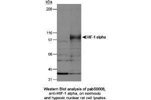 Image no. 2 for anti-Hypoxia Inducible Factor 1, alpha Subunit (Basic Helix-Loop-Helix Transcription Factor) (HIF1A) (AA 432-528) antibody (ABIN363317) (HIF1A Antikörper  (AA 432-528))