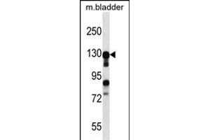 MKL2 antibody  (N-Term)