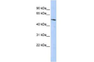 WB Suggested Anti-BCL6B Antibody Titration:  0. (BCL6B Antikörper  (Middle Region))