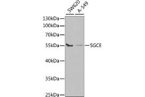 Western blot analysis of extracts of various cell lines, using SGCE antibody (ABIN6132885, ABIN6147703, ABIN6147704 and ABIN6220961) at 1:1000 dilution. (SGCE Antikörper  (AA 1-317))