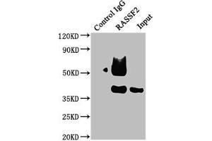 Immunoprecipitating RASSF2 in Raji whole cell lysate Lane 1: Rabbit control IgG instead of ABIN7167126 in Raji whole cell lysate.