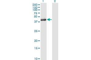 Western Blot analysis of SGK2 expression in transfected 293T cell line by SGK2 monoclonal antibody (M02), clone 1A7. (SGK2 Antikörper  (AA 293-367))