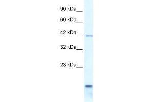WB Suggested Anti-P2RXL1 Antibody Titration:  0. (P2RX6 Antikörper  (N-Term))