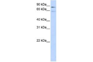 WB Suggested Anti-F13B Antibody Titration:  0. (F13B Antikörper  (Middle Region))