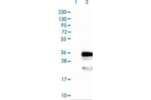 Western blot analysis of Lane 1: Negative control (vector only transfected HEK293T lysate) Lane 2: Over-expression lysate (Co-expressed with a C-terminal myc-DDK tag (~3. (FBXO44 Antikörper)