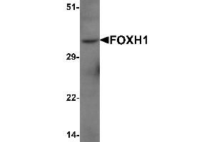 Western Blotting (WB) image for anti-Forkhead Box H1 (FOXH1) (N-Term) antibody (ABIN1077399) (FOXH1 Antikörper  (N-Term))