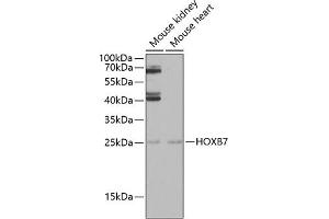 Western blot analysis of extracts of various cell lines, using HOXB7 antibody (ABIN6128065, ABIN6141944, ABIN6141945 and ABIN6222665) at 1:1000 dilution.