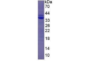 Image no. 2 for Plasminogen (PLG) (AA 100-352) protein (His tag) (ABIN1880020) (PLG Protein (AA 100-352) (His tag))