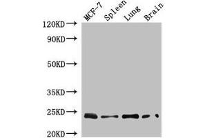 Western Blot Positive WB detected in: MCF-7 whole cell lysate, Mouse spleen tissue, Mouse lung tissue, Mouse brain tissue All lanes: RAB25 antibody at 4 μg/mL Secondary Goat polyclonal to rabbit IgG at 1/50000 dilution Predicted band size: 24 kDa Observed band size: 24 kDa (RAB25 Antikörper  (AA 1-210))