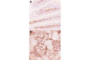 Immunohistochemical staining (Frozen sections) of mouse intestine tissue (A) and rat kidney tissue (B) with ABCB1 polyclonal antibody  under 0. (ABCB1 Antikörper  (AA 621-650))