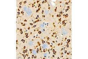 Immunohistochemistry of paraffin embedded rat brain using P4H (ABIN7074215) at dilution of 1:700 (400x lens) (HIF Prolyl Hydroxylase Antikörper)
