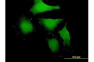 Immunofluorescence of purified MaxPab antibody to MBIP on HeLa cell.