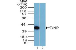 Image no. 1 for anti-Thioredoxin Interacting Protein (TXNIP) (AA 100-150) antibody (ABIN960393) (TXNIP Antikörper  (AA 100-150))