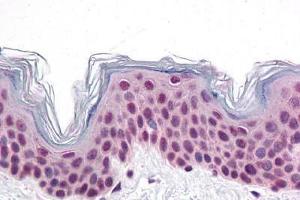 Human Skin: Formalin-Fixed, Paraffin-Embedded (FFPE) (CDC27 Antikörper  (C-Term))