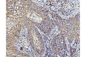IHC analysis of CD147/Emmprin using anti-CD147/Emmprin antibody (ABIN7599997). (CD147 Antikörper  (AA 138-323))