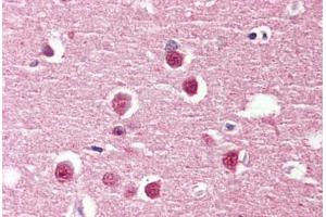 Brain, cortex, Human: Formalin-Fixed, Paraffin-Embedded (FFPE) (ADGRV1 / GPR98 Antikörper  (Internal Region))