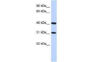 Western Blotting (WB) image for anti-Family with Sequence Similarity 46, Member D (FAM46D) antibody (ABIN2459624) (FAM46D Antikörper)