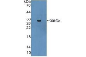 Detection of Recombinant MAP1A, Mouse using Polyclonal Antibody to Microtubule Associated Protein 1A (MAP1A) (MAP1A Antikörper  (AA 2552-2759))