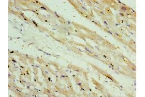 Immunohistochemistry of paraffin-embedded human heart tissue using ABIN7170926 at dilution of 1:100 (OXCT1 Antikörper  (AA 261-520))