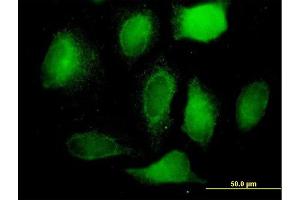 Immunofluorescence of purified MaxPab antibody to BCAP31 on HeLa cell. (BCAP31 Antikörper  (AA 1-246))