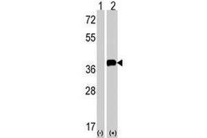 Western blot analysis of SNAI1 (arrow) using SNAI1 polyclonal antibody . (SNAIL Antikörper  (N-Term))