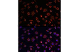 Immunofluorescence analysis of L929 cells using ULK1 antibody (ABIN6134005, ABIN6149921, ABIN6149922 and ABIN6224624) at dilution of 1:100. (ULK1 Antikörper  (AA 400-499))