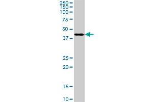 PDK2 monoclonal antibody (M02), clone 5F8. (PDK2 Antikörper  (AA 187-276))