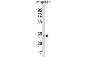 Western Blotting (WB) image for anti-Triggering Receptor Expressed On Myeloid Cells-Like 1 (TREML1) antibody (ABIN3000417) (TREML1 Antikörper)