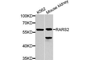 Western blot analysis of extracts of various cell lines, using RARS2 antibody. (RARS2 Antikörper)