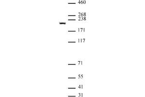 Tet1 (pAb) tested by Western blot. (TET1 Antikörper  (C-Term))