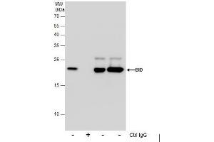 IP Image Immunoprecipitation of Bid protein from Jurkat whole cell extracts using 5 μg of Bid antibody [N1C3] , or Bid antibody [N1C3-2], Western blot analysis was performed using Bid antibody [N1C3], EasyBlot anti-Rabbit IgG  was used as a secondary reagent. (BID Antikörper)