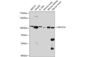 Western blot analysis of extracts of various cell lines, using NF antibody (ABIN7268979) at 1:1000 dilution. (NFATC4 Antikörper  (AA 560-710))