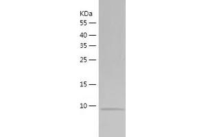 Western Blotting (WB) image for Jumping Translocation Breakpoint (JTB) (AA 31-105) protein (His tag) (ABIN7284676) (JTB Protein (AA 31-105) (His tag))