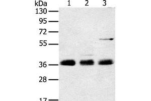 Western Blot analysis of Mouse lung tissue, NIH/3T3 and hepg2 cell using ANKRD1 Polyclonal Antibody at dilution of 1:400 (ANKRD1 Antikörper)