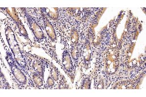 Immunohistochemistry (IHC) image for anti-FK506 Binding Protein 7 (FKBP7) (AA 24-217) antibody (ABIN7443236)