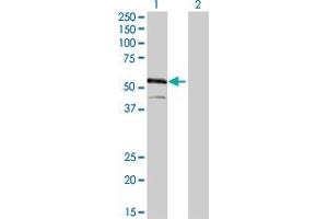Western Blot analysis of IRF4 expression in transfected 293T cell line by IRF4 monoclonal antibody (M02), clone 2F2.