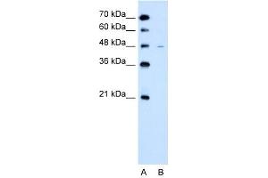 WB Suggested Anti-SLC43A3  Antibody Titration: 2.