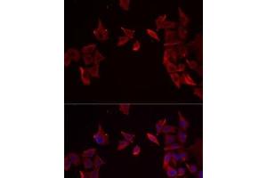 Immunofluorescence analysis of MCF7 cells using RAMP3 Polyclonal Antibody (RAMP3 Antikörper)