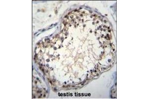 OVOS Antibody (N-term) (ABIN655570 and ABIN2845070)a immunohistochemistry analysis in formalin fixed and paraffin embedded human testis tissue followed by peroxidase conjugation of the secondary antibody and DAB staining. (OVOS1 (AA 99-128), (N-Term) Antikörper)
