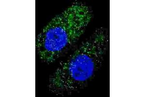 Immunofluorescence (IF) image for anti-ATG5 Autophagy Related 5 (ATG5) antibody (ABIN2999977) (ATG5 Antikörper)