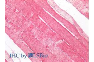 ABIN768566 (5µg/ml) staining of paraffin embedded Human Skeletal Muscle. (SOD2 Antikörper  (AA 119-130))