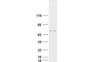 Validation with Western Blot