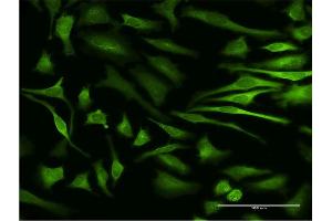 Immunofluorescence of monoclonal antibody to MAPKAPK5 on HeLa cell. (MAPKAP Kinase 5 Antikörper  (AA 371-471))